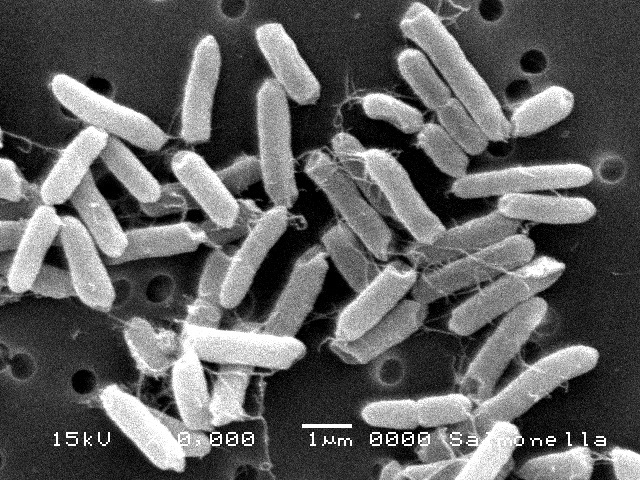 サルモネラ属菌の顕微鏡写真
