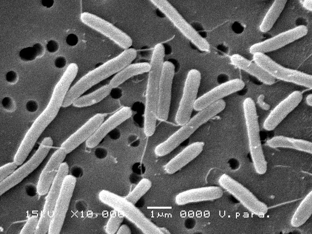 腸炎ビブリオの顕微鏡写真