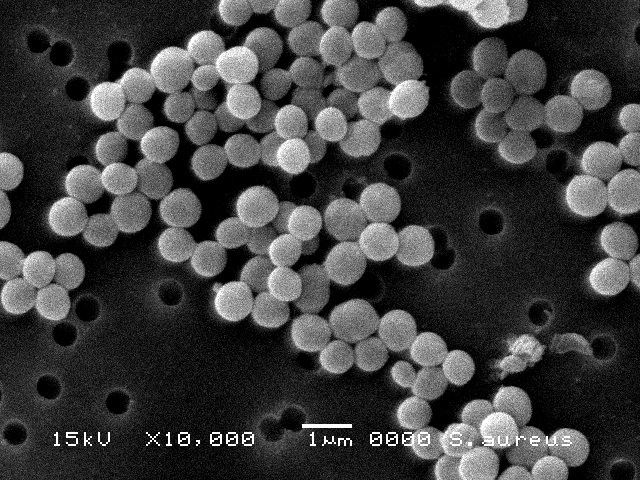 黄色ブドウ球菌の顕微鏡写真