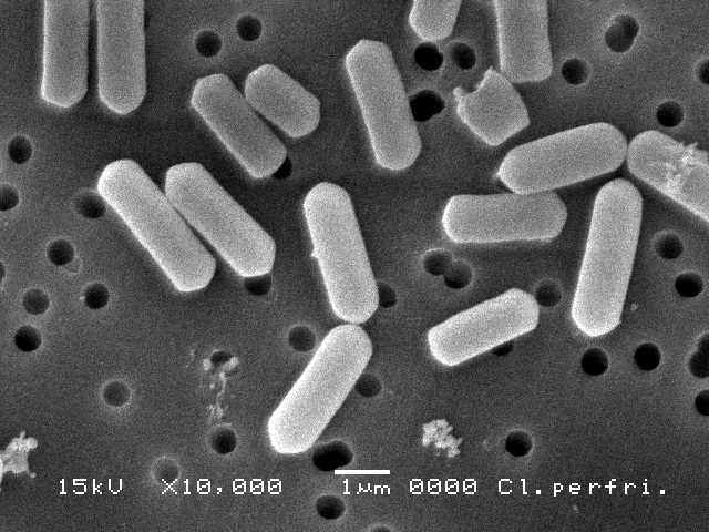 ウエルシュ菌の顕微鏡写真