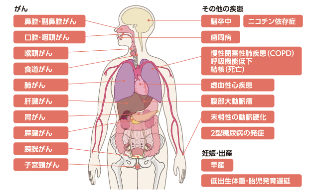 たばこによるがんや脳卒中などの疾患、妊娠・出産への影響を表すイラスト